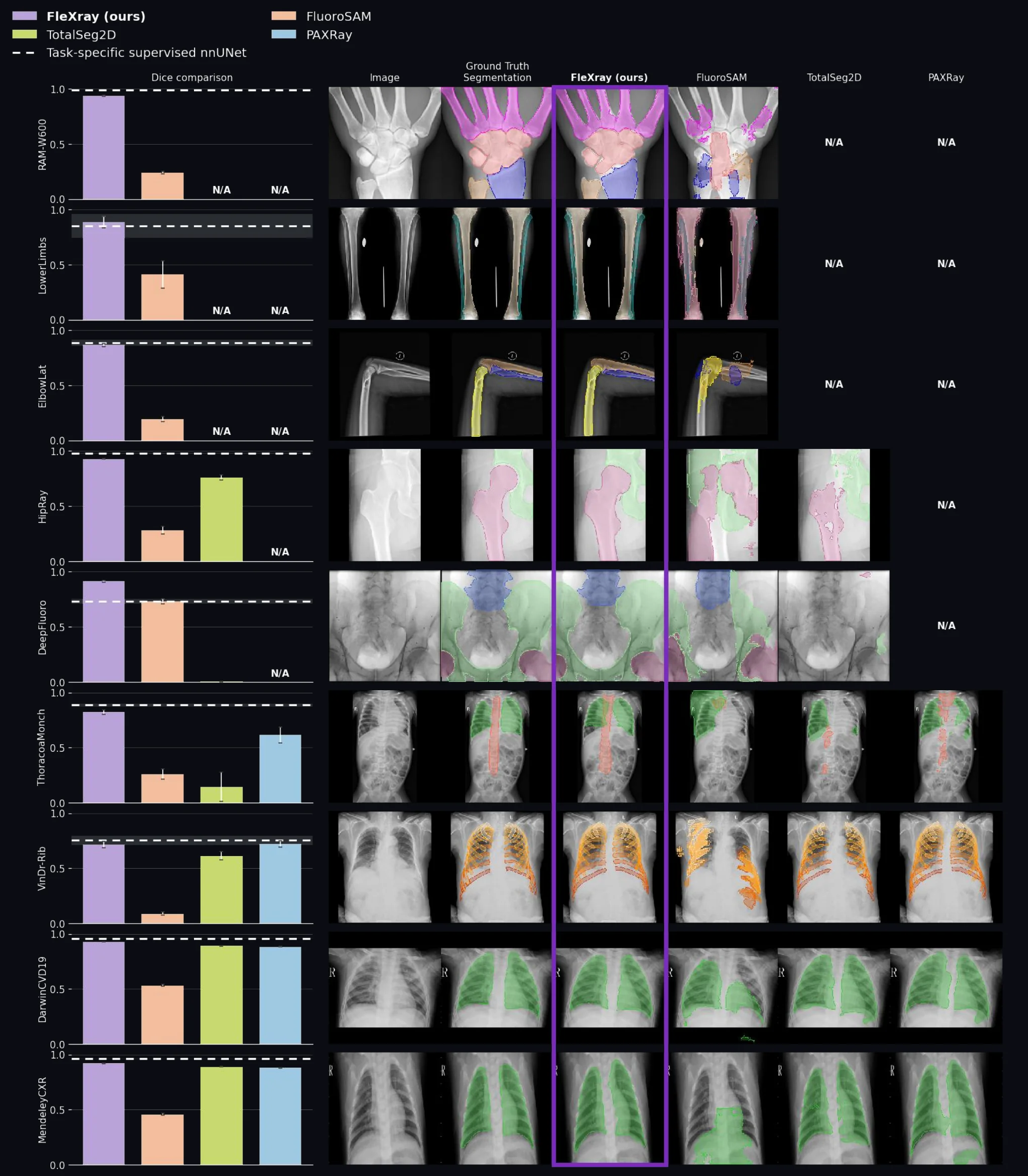 Benchmark figure showing FleXray scores and segmentation examples across nine held-out real X-ray datasets against FluoroSAM, TotalSegmentator2D, PAXray, and task-specific networks.