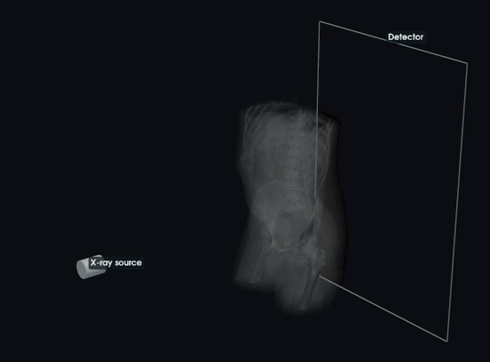 Animation of X-ray rays traveling from a source through an abdominal and pelvic CT volume to a detector.