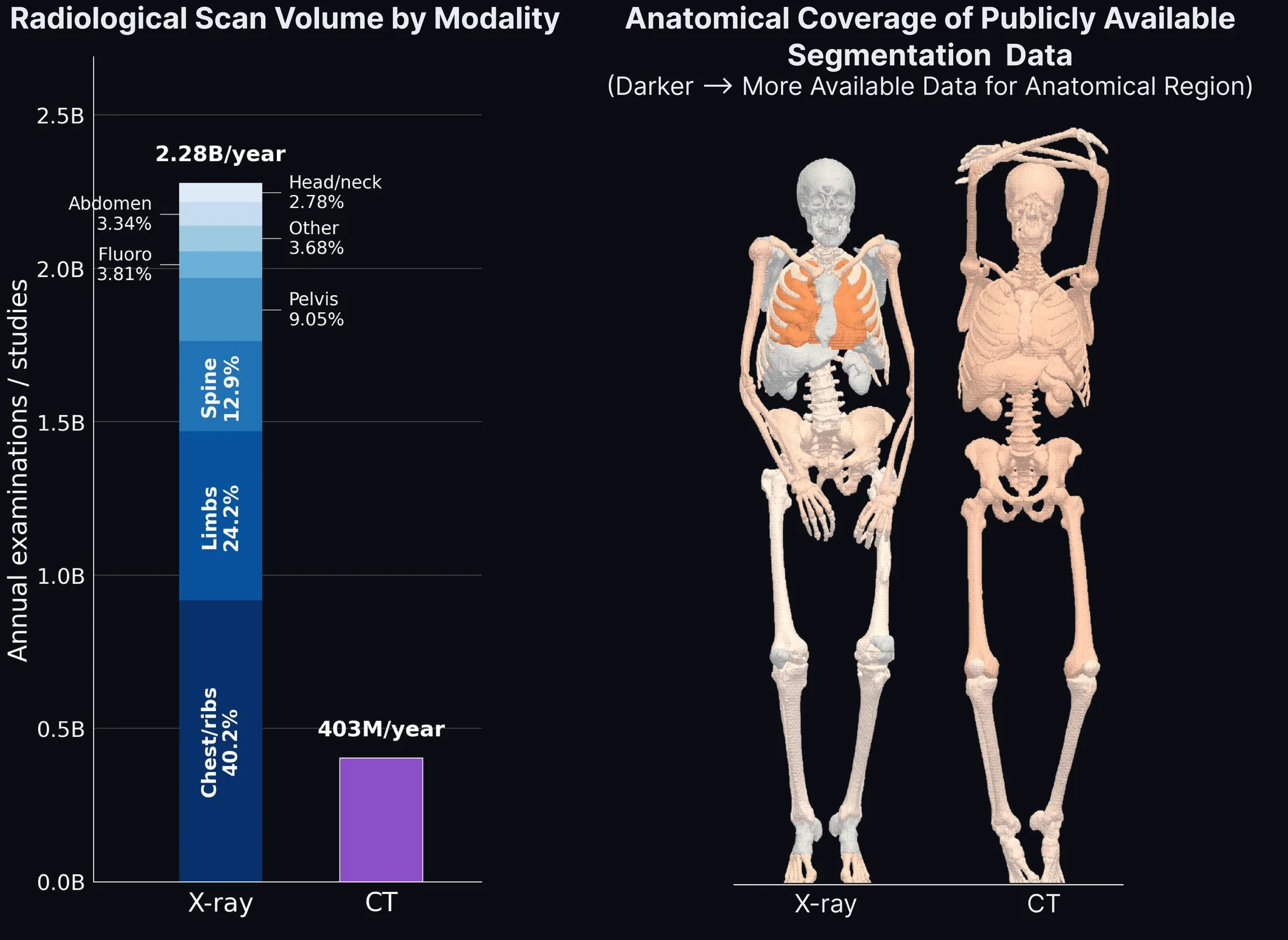 Bar chart showing 2.28 billion annual X-ray examinations versus 403 million CT studies, next to skeletons showing that publicly available segmentation data covers CT anatomy far more completely than X-ray.