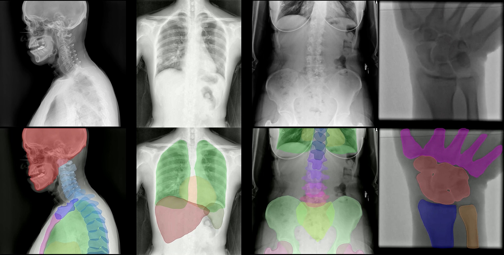 Collage of radiographs from head, chest, abdomen, and wrist; the top row shows input X-rays and the bottom row shows colored FleXray anatomy predictions.