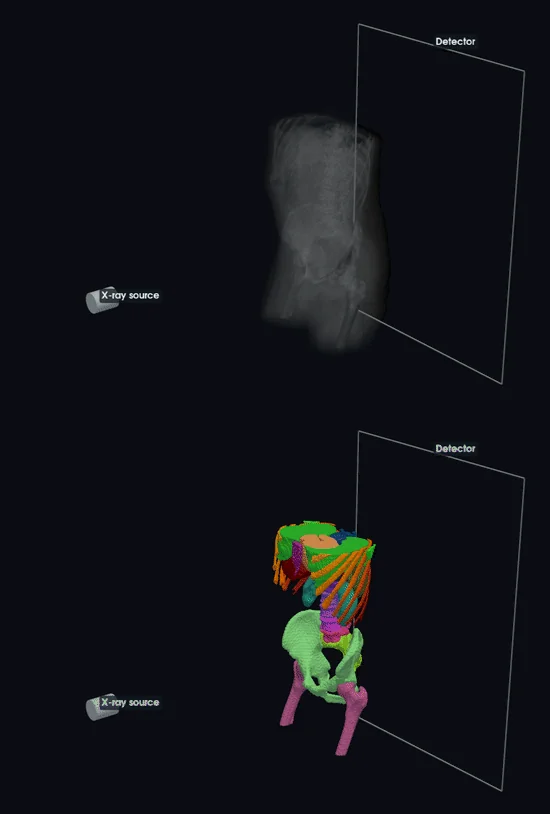 Top: an X-ray source, an abdominal and pelvic CT volume, and a detector. Bottom: the same geometry with labeled anatomy. Both panels animate together to show ray-casting into paired radiographs and segmentation labels.