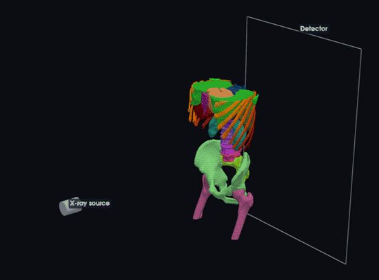 Animation of the same X-ray geometry ray-casting labeled abdominal and pelvic anatomy to a detector.